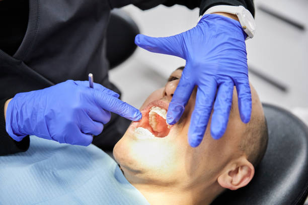 Best Emergency Dental Care for Broken or Chipped Teeth in North Springfield, VA